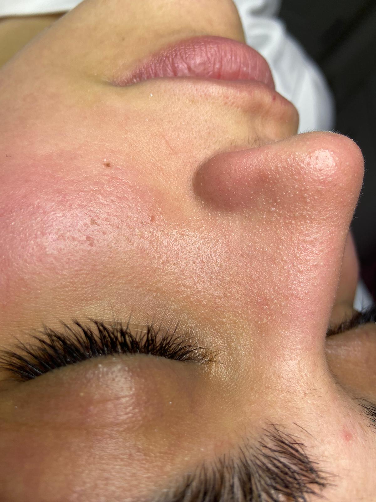 Bölgesel İncelme Öncesi