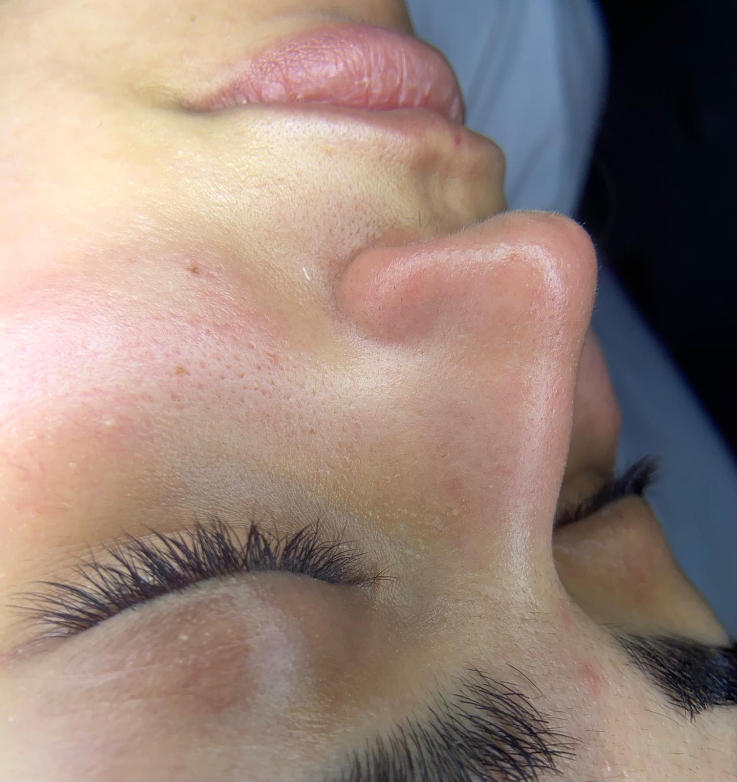 Bölgesel İncelme Sonrası