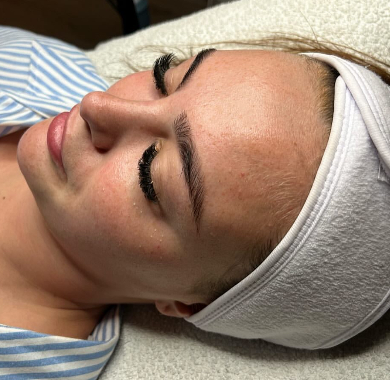 Leke Bakımı Öncesi